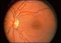 Normal Retina